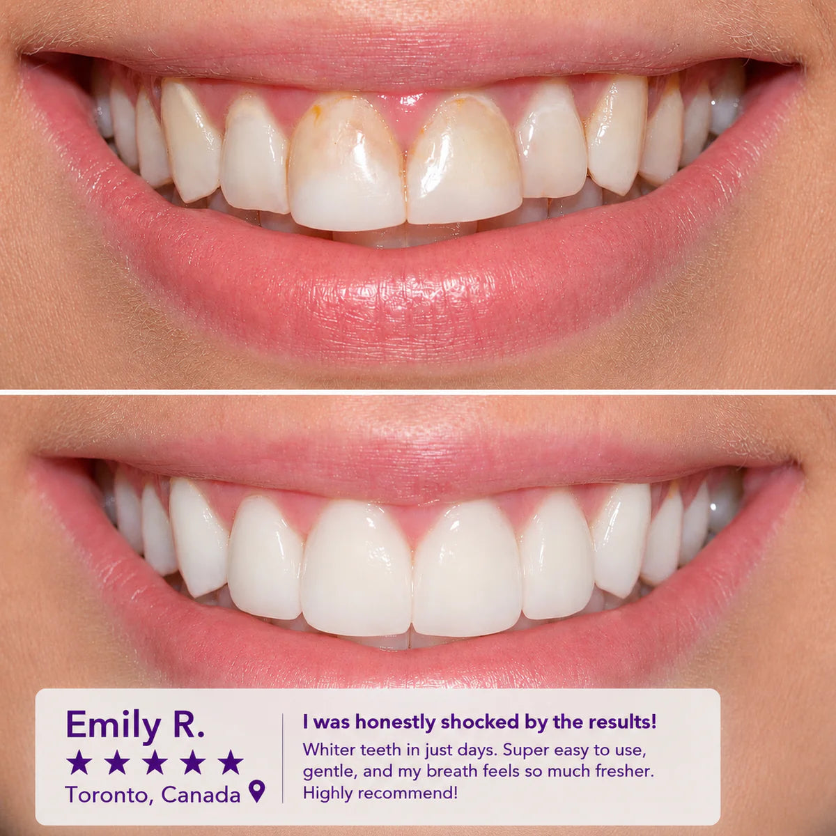 Teeth Whitening Mouthwash