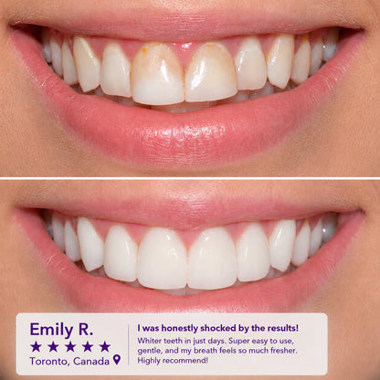 Teeth Whitening Mouthwash